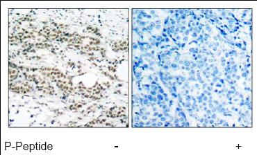 Immunohistochemistry (Formalin/PFA-fixed paraffin-embedded sections) - Anti-FOXO4/AFX (phospho S197) antibody (AB47278)