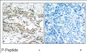 Immunohistochemistry (Formalin/PFA-fixed paraffin-embedded sections) - Anti-FOXO4/AFX (phospho S197) antibody (AB47278)