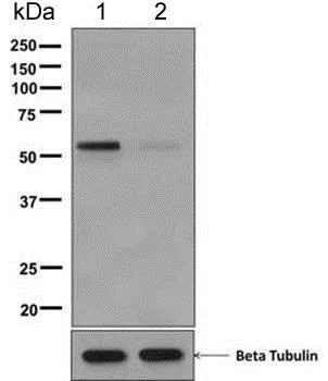 Western blot - Anti-Foxo6 (phospho S184) antibody [EPR6863] - BSA and Azide free (AB249138)