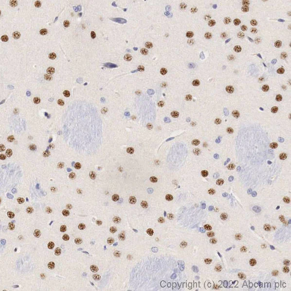 Immunohistochemistry (Formalin/PFA-fixed paraffin-embedded sections) - Anti-FOXP1 antibody (AB16645)