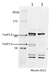 Western blot - Anti-FOXP1 antibody (AB16645)