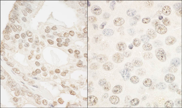 Immunohistochemistry (Formalin/PFA-fixed paraffin-embedded sections) - Anti-FOXP1 antibody (AB93807)