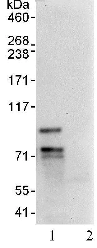 Immunoprecipitation - Anti-FOXP1 antibody (AB93807)