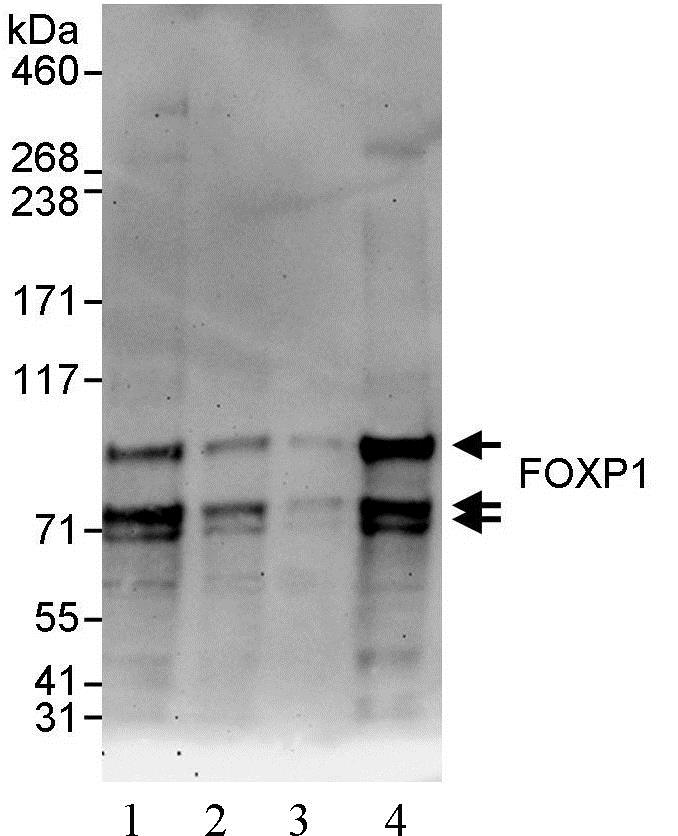 Western blot - Anti-FOXP1 antibody (AB93807)