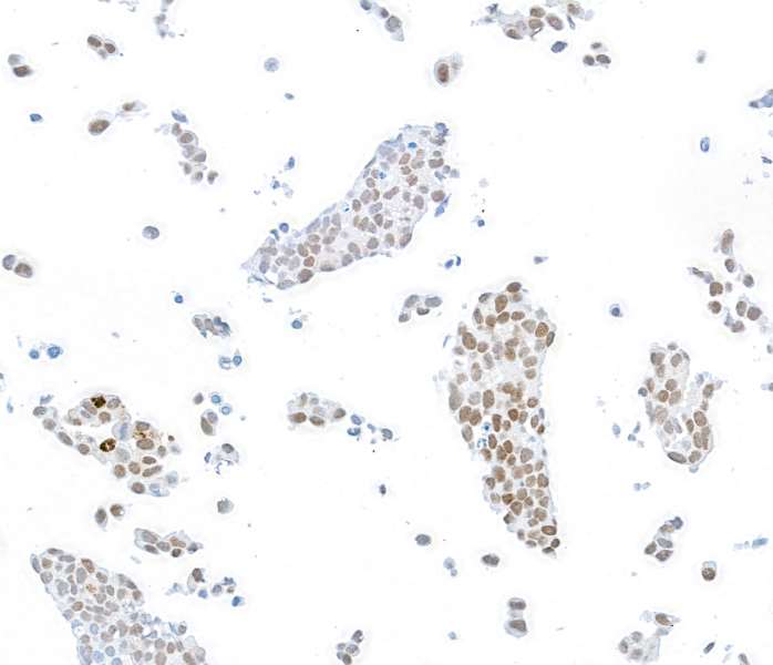 Immunocytochemistry - Anti-FOXP1 antibody [BLR134H] - BSA free (AB314052), expandable thumbnail