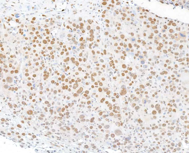 Immunohistochemistry (Formalin/PFA-fixed paraffin-embedded sections) - Anti-FOXP1 antibody [BLR134H] - BSA free (AB314052)