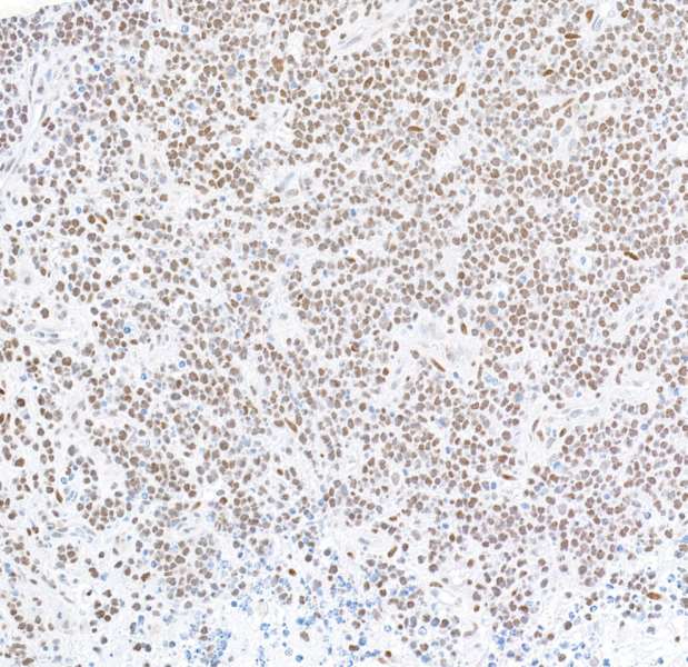 Immunohistochemistry (Formalin/PFA-fixed paraffin-embedded sections) - Anti-FOXP1 antibody [BLR134H] - BSA free (ab314052), expandable thumbnail