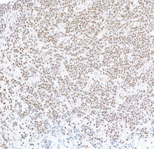Immunohistochemistry (Formalin/PFA-fixed paraffin-embedded sections) - Anti-FOXP1 antibody [BLR134H] - BSA free (AB314052)