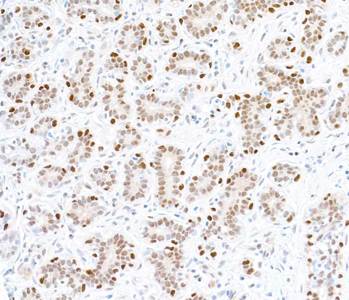 Immunohistochemistry (Formalin/PFA-fixed paraffin-embedded sections) - Anti-FOXP1 antibody [BLR134H] - BSA free (AB314052)