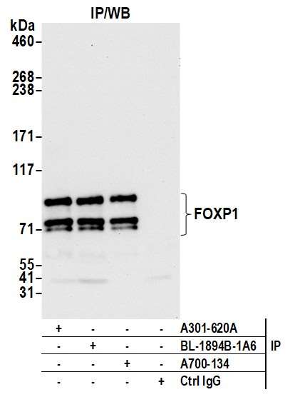 Immunoprecipitation - Anti-FOXP1 antibody [BLR134H] - BSA free (AB314052), expandable thumbnail