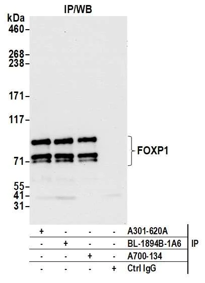 Immunoprecipitation - Anti-FOXP1 antibody [BLR134H] - BSA free (AB314052)