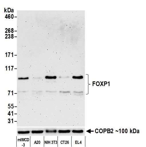Western blot - Anti-FOXP1 antibody [BLR134H] - BSA free (AB314052), expandable thumbnail