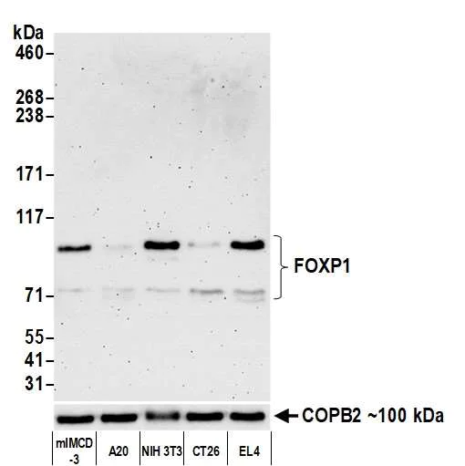Western blot - Anti-FOXP1 antibody [BLR134H] - BSA free (AB314052)