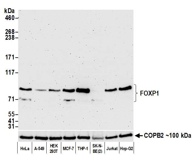 Western blot - Anti-FOXP1 antibody [BLR134H] - BSA free (AB314052), expandable thumbnail