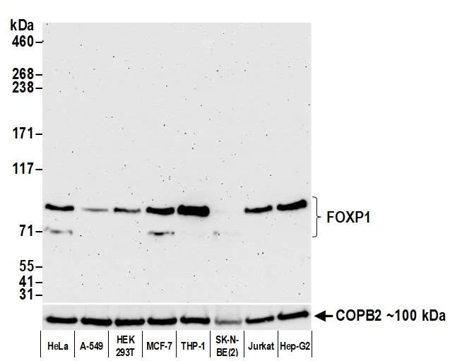 Western blot - Anti-FOXP1 antibody [BLR134H] - BSA free (AB314052)