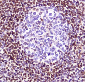 Immunohistochemistry (Formalin/PFA-fixed paraffin-embedded sections) - Anti-FOXP1 antibody - C-terminal (AB227788)