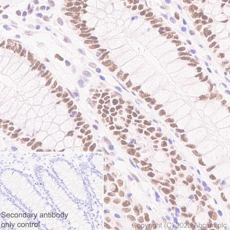 Immunohistochemistry (Formalin/PFA-fixed paraffin-embedded sections) - Anti-FOXP1 antibody [EPR26484-79] - BSA and Azide free (AB314489)