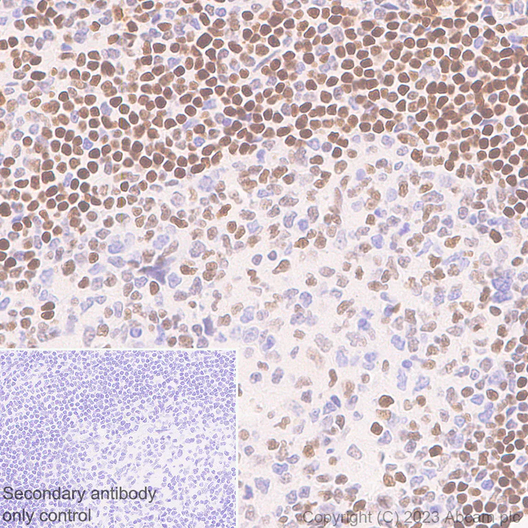 Immunohistochemistry (Formalin/PFA-fixed paraffin-embedded sections) - Anti-FOXP1 antibody [EPR26484-79] - BSA and Azide free (AB314489)