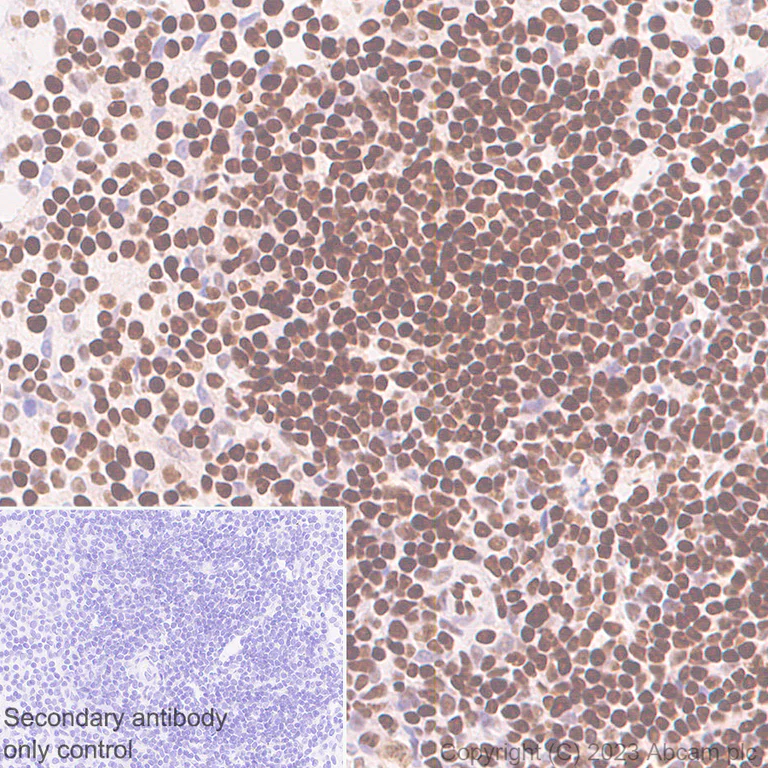 Immunohistochemistry (Formalin/PFA-fixed paraffin-embedded sections) - Anti-FOXP1 antibody [EPR26484-79] - BSA and Azide free (AB314489)