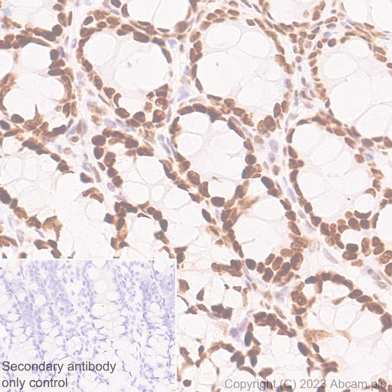 Immunohistochemistry (Formalin/PFA-fixed paraffin-embedded sections) - Anti-FOXP1 antibody [EPR26484-79] - BSA and Azide free (AB314489)