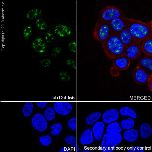 Immunocytochemistry/ Immunofluorescence - Anti-FOXP1 antibody [EPR4113] (AB134055)