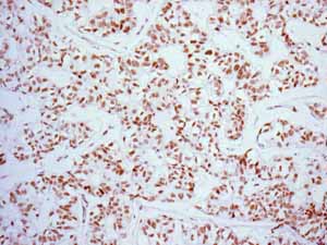 Immunohistochemistry (Formalin/PFA-fixed paraffin-embedded sections) - Anti-FOXP1 antibody [EPR4113] (ab134055), expandable thumbnail