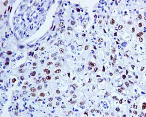 Immunohistochemistry (Formalin/PFA-fixed paraffin-embedded sections) - Anti-FOXP1 antibody [EPR4113] (ab134055), expandable thumbnail