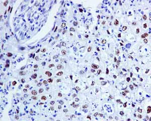 Immunohistochemistry (Formalin/PFA-fixed paraffin-embedded sections) - Anti-FOXP1 antibody [EPR4113] (AB134055)
