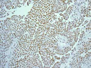 Immunohistochemistry (Formalin/PFA-fixed paraffin-embedded sections) - Anti-FOXP1 antibody [EPR4113] (ab134055), expandable thumbnail