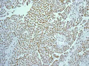 Immunohistochemistry (Formalin/PFA-fixed paraffin-embedded sections) - Anti-FOXP1 antibody [EPR4113] (AB134055)