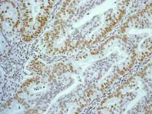 Immunohistochemistry (Formalin/PFA-fixed paraffin-embedded sections) - Anti-FOXP1 antibody [EPR4113] (AB134055)