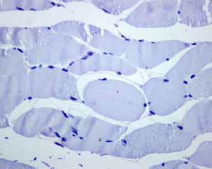 Immunohistochemistry (Formalin/PFA-fixed paraffin-embedded sections) - Anti-FOXP1 antibody [EPR4113] (ab134055), expandable thumbnail