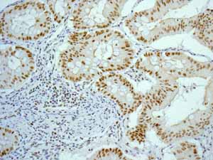 Immunohistochemistry (Formalin/PFA-fixed paraffin-embedded sections) - Anti-FOXP1 antibody [EPR4113] (AB134055), expandable thumbnail