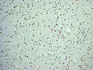 Immunohistochemistry (Formalin/PFA-fixed paraffin-embedded sections) - Anti-FOXP1 antibody [EPR4113] (ab134055), expandable thumbnail