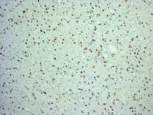 Immunohistochemistry (Formalin/PFA-fixed paraffin-embedded sections) - Anti-FOXP1 antibody [EPR4113] (AB134055)