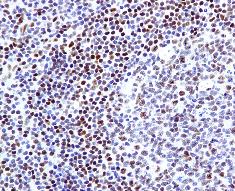 Immunohistochemistry (Formalin/PFA-fixed paraffin-embedded sections) - Anti-FOXP1 antibody [EPR4113] (ab134055), expandable thumbnail
