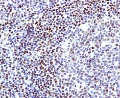 Immunohistochemistry (Formalin/PFA-fixed paraffin-embedded sections) - Anti-FOXP1 antibody [EPR4113] (AB134055)