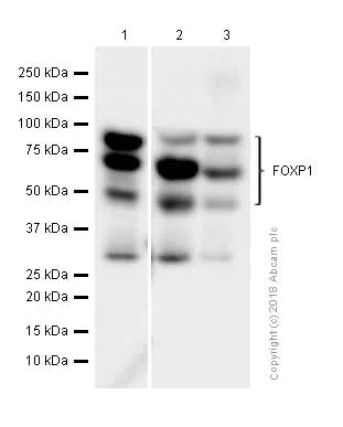 Western blot - Anti-FOXP1 antibody [EPR4113] (AB134055)