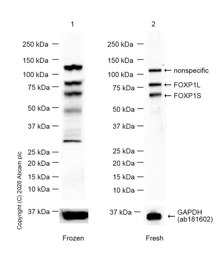 Western blot - Anti-FOXP1 antibody [EPR4113] (AB134055)