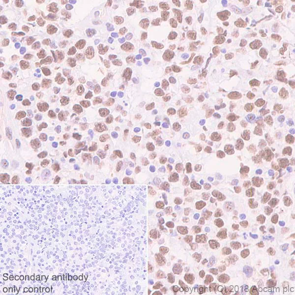 Immunohistochemistry (Formalin/PFA-fixed paraffin-embedded sections) - Anti-FOXP1 antibody [EPR4113] - BSA and Azide free (AB248661)