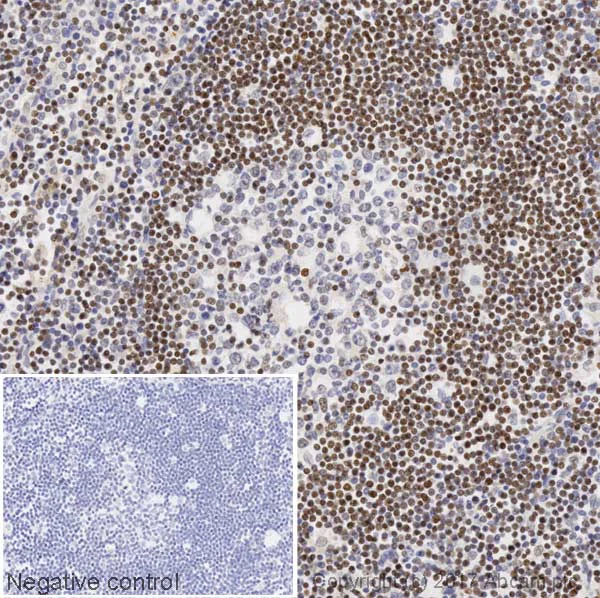 Immunohistochemistry (Formalin/PFA-fixed paraffin-embedded sections) - Anti-FOXP1 antibody [JC12] (AB32010)