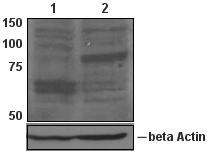 Western blot - Anti-FOXP1 antibody [JC12] (AB32010), expandable thumbnail