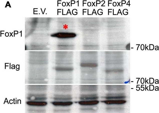 Western blot - Anti-FOXP1 antibody [JC12] (AB32010), expandable thumbnail