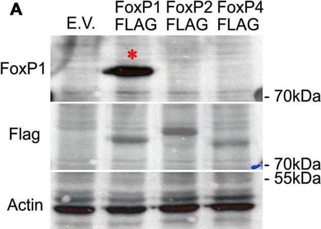 Western blot - Anti-FOXP1 antibody [JC12] (AB32010)
