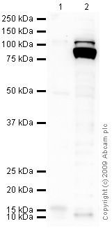 Western blot - Anti-FOXP1 antibody [JC12] (AB32010), expandable thumbnail