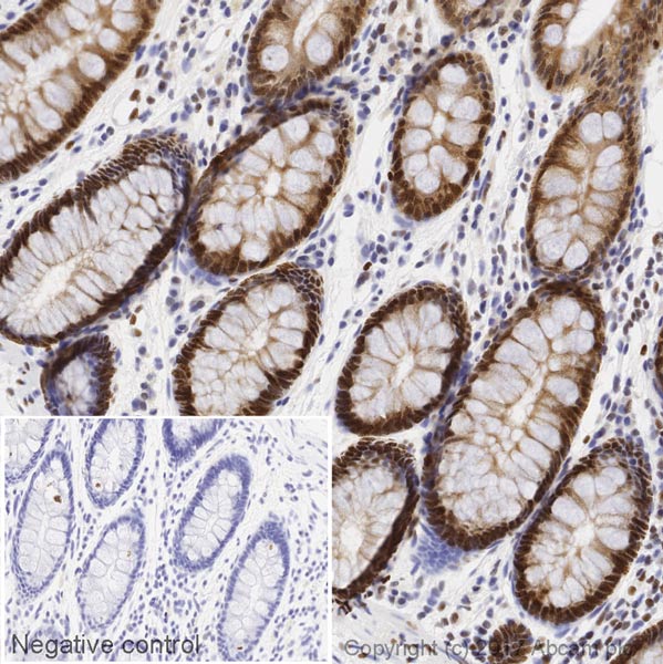Immunohistochemistry (Formalin/PFA-fixed paraffin-embedded sections) - Anti-FOXP1 antibody [JC12] - BSA and Azide free (AB264529)