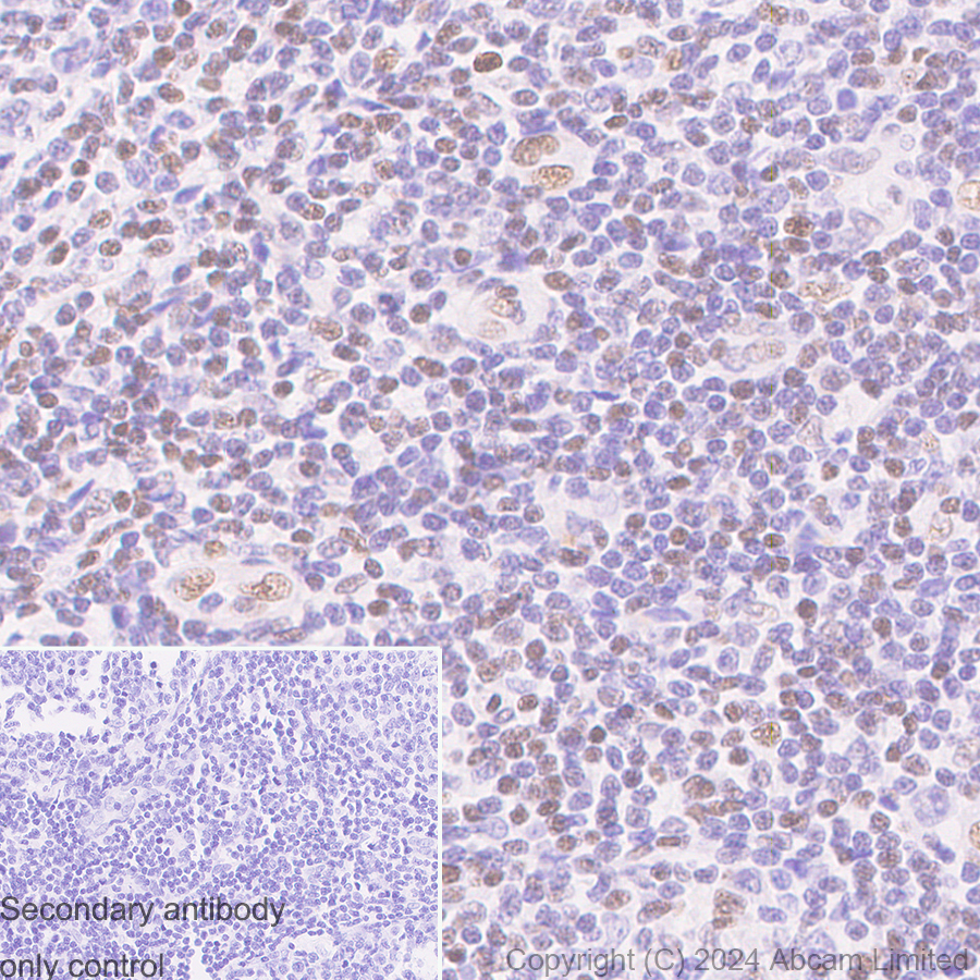 Immunohistochemistry (Formalin/PFA-fixed paraffin-embedded sections) - Anti-FOXP1 antibody [RM1113] (AB320745)