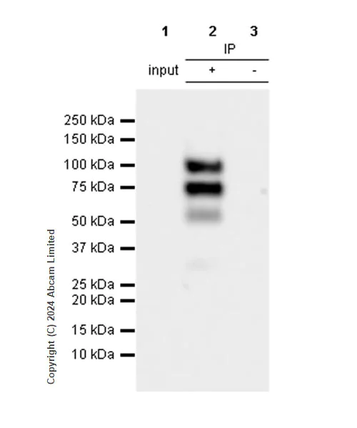 Immunoprecipitation - Anti-FOXP1 antibody [RM1113] (AB320745)