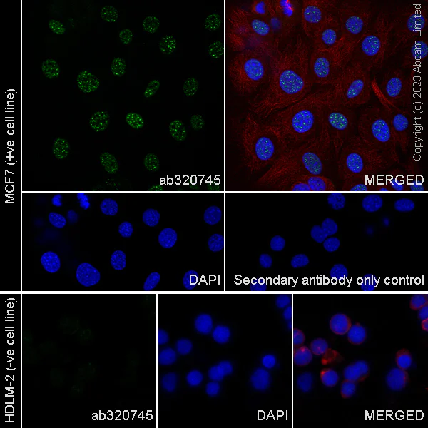 Immunocytochemistry/ Immunofluorescence - Anti-FOXP1 antibody [RM1113] - BSA and Azide free (AB320746)