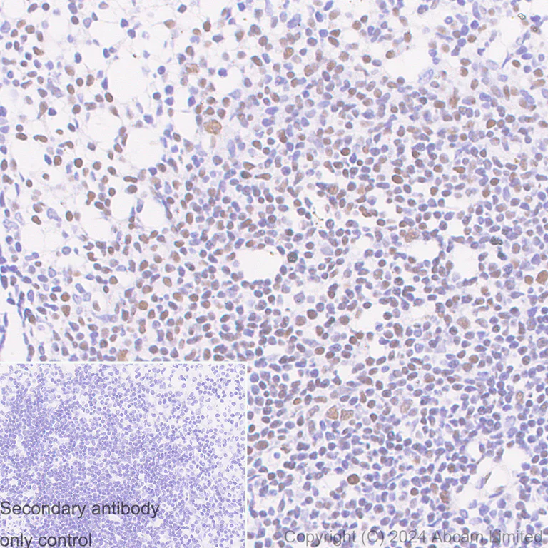 Immunohistochemistry (Formalin/PFA-fixed paraffin-embedded sections) - Anti-FOXP1 antibody [RM1113] - BSA and Azide free (AB320746)
